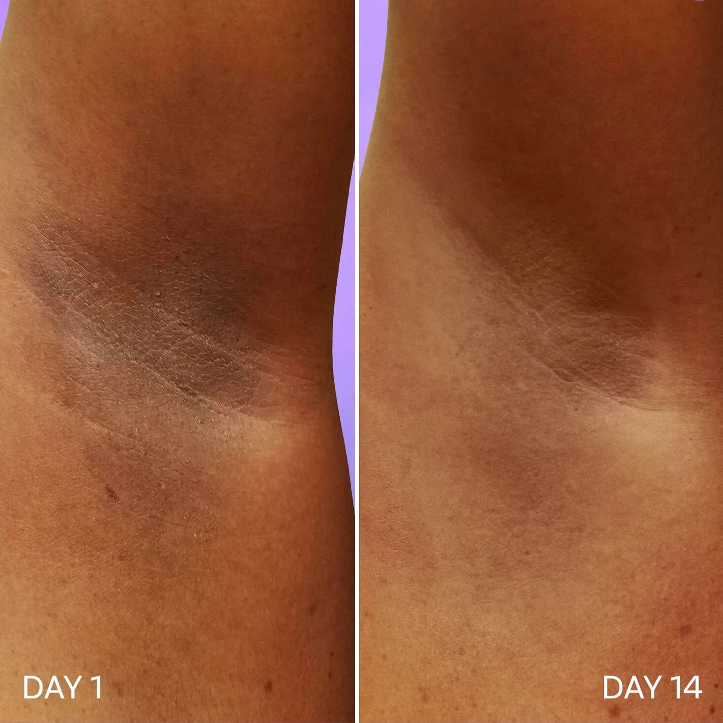 Under Arm Roll On | 40ml