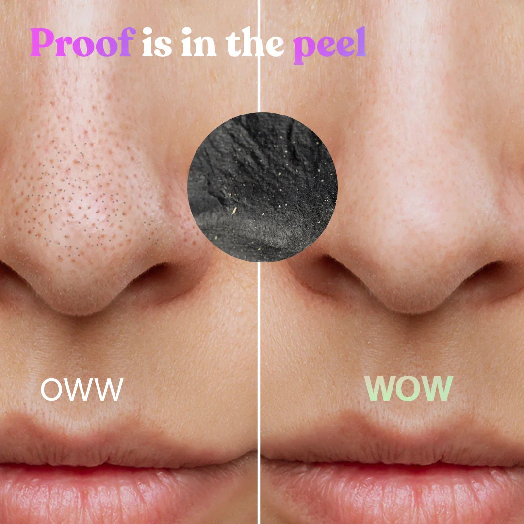 Charcoal Nose Strip | Pack of 3